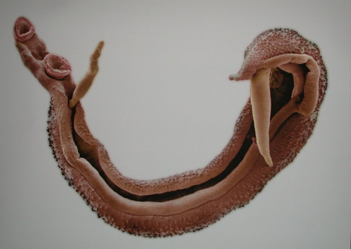 Шистосомоз: червь