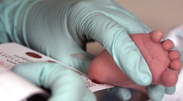Забор крови у двухнедельного ребенка для теста на фенилкетонурию