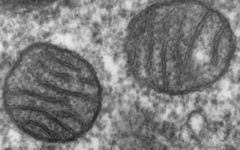 Электронномикроскопическая фотография, показывающая митохондрии человека в поперечном сечении