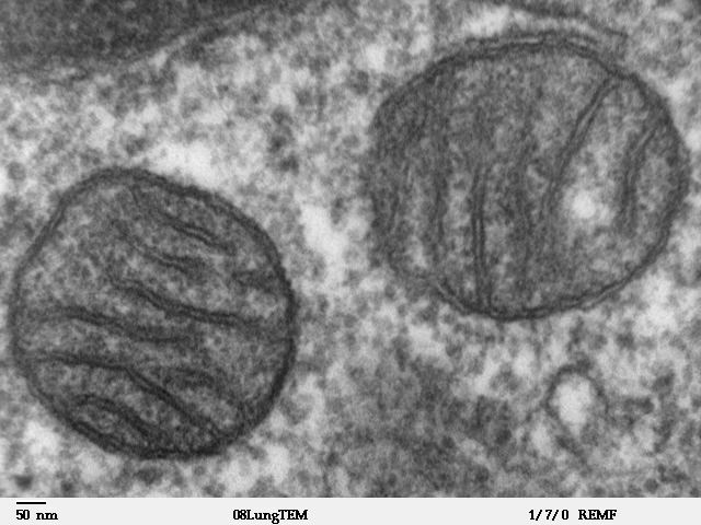 Электронномикроскопическая фотография, показывающая митохондрии человека в поперечном сечении