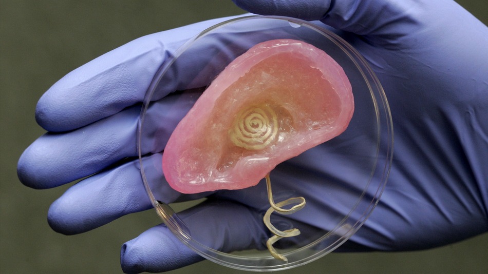 Созданное на 3D принтере ухо человека со встроенными электронными компонентами для искусственного слуха.