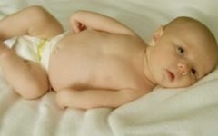 Артрогрипоз у новорожденного