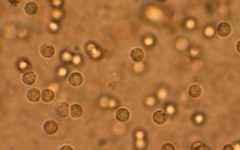 Лейкоциты под микроскопом в анализе мочи