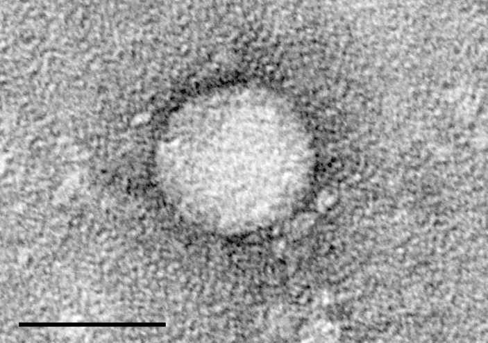 Электронная микрофотография вируса гепатита С, выделенного из клеточной культуры (шкала 50 нм).