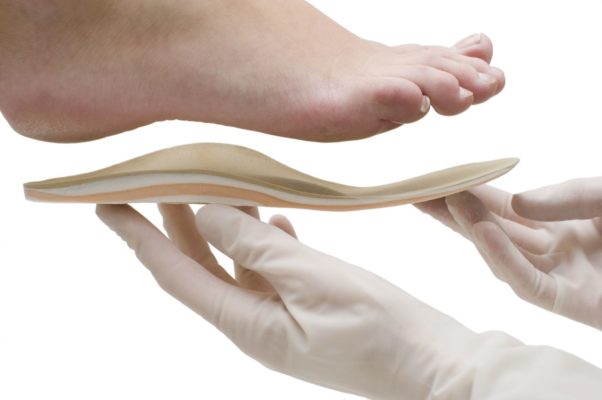 Ортопедические стельки при вальгусной деформации большого пальца стопы.